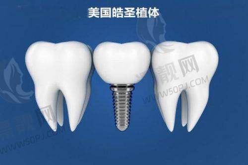 口碑与用户反馈