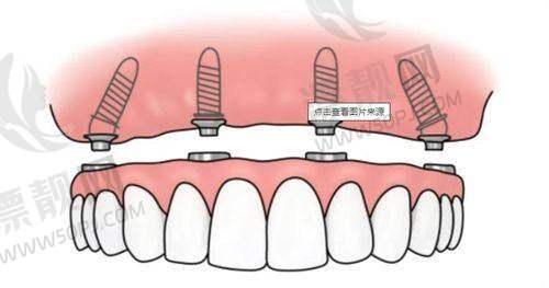 牙元素口腔都能看什么科室？综合服务并不只是“种牙”