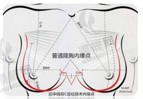 选择建议