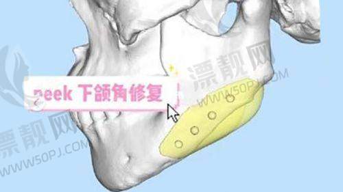 选择正规医院的重要性