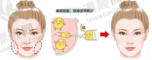 广东佛山市复星禅诚医院是公立医院吗？一文带你了解其医美服务及性质