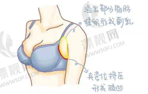 女性私密ADM紧缩针一针多少钱？私密紧缩术详解、效果及价格影响因素大揭秘