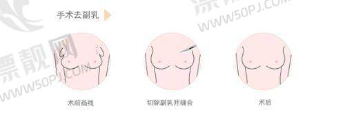 多重修复机制,全方面呵护