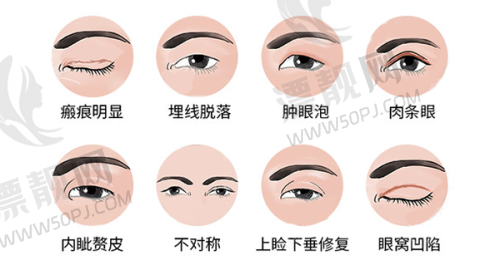 成都东篱医院具有影响力双眼皮医生大揭秘