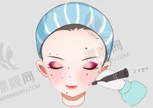 激光点痣后的护理小妙招