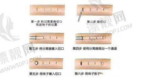 5. 西安米兰柏羽医疗美容医院
