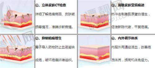 海口赵晓兰医生做眼睛怎么样？海南华美眼整形专家1小时打造无痕翘睫双眼皮