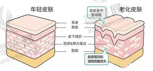 选择建议:让变得更美之路更加顺畅