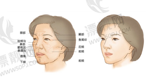 价格大揭秘：性价比与高端体验的抉择