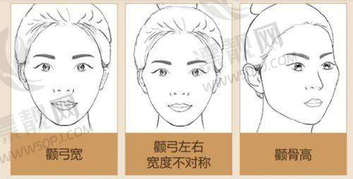 眼周年轻化的毫米级战争