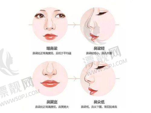 广州做眼袋有名的医院排名前十：中山大学附属第一医院、广州曙光整形美容医院、广东省人民医院领衔！