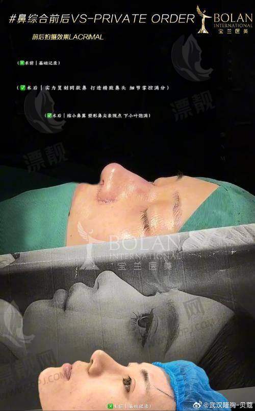 术后服务贴心更“加分”，全流程服务闭环