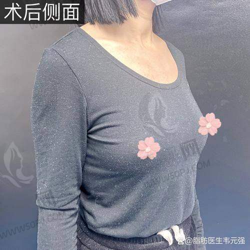 预约四川华 西整容科，攻略要比化妆品管用一百倍！