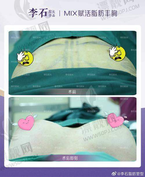 四川华西医院整容科怎么预约面诊？具体预约挂号方式分享给你还有价格表参考
