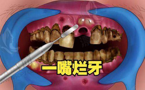 好多人不知道沈阳有几家牙元素口腔，本篇为你解惑牙元素口腔医院地址\价格表