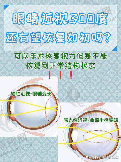医生亲诊能不加钱？茗视光就是有这魄力！
