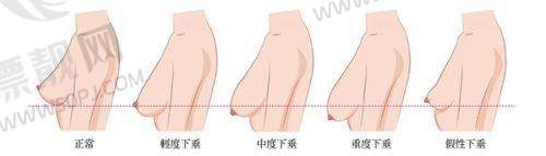 手术过程全解析
