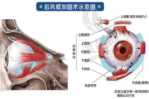 专精团队:为手术保驾护航