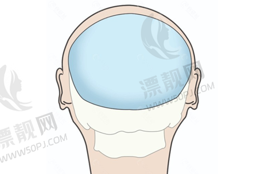邯郸兰星与其他医美机构的对比优势