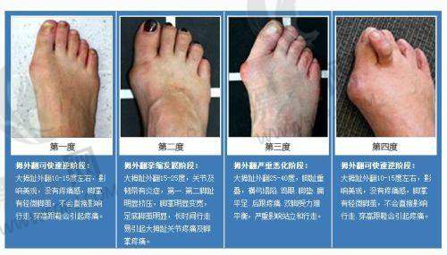 武汉月目医疗打造“妈生感”自然成效