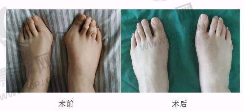 上海健桥医院的医美项目优势及适合人群