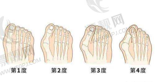 选择温州艺星整形医院和这两位医生的好处