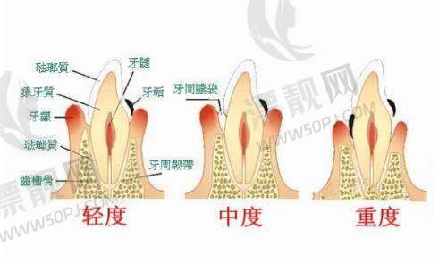 新疆石河子徐国伟医生私密整形优势解读