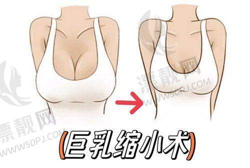 硅胶弹力线面部提升安心吗?