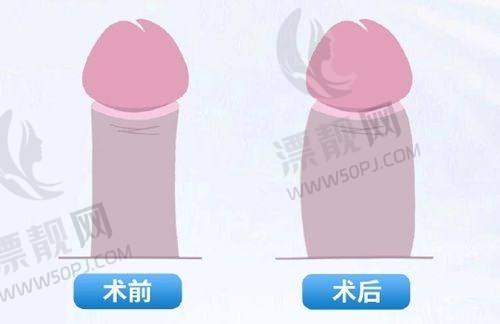 武汉付毅隆鼻怎么联系？3种预约方式揭秘，打造精致鼻型就选中翰整形