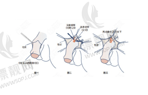 6. 韩国伊美芝整形外科 - 眼部整形艺术大师