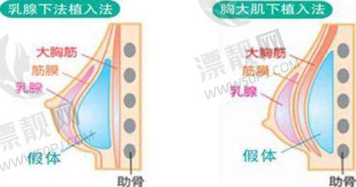 术后管理:专精指导,助力理想修复