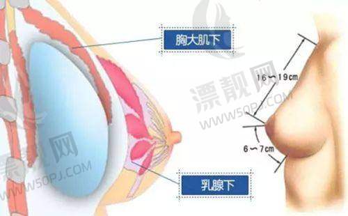 患者的真实反馈,见证杨东运医生的实力