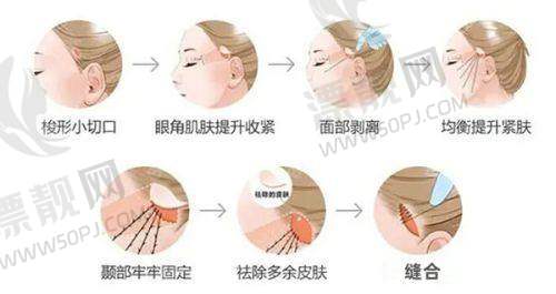 技术为王,实力超群