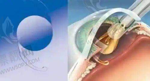 如何选择适合自己的整形医院