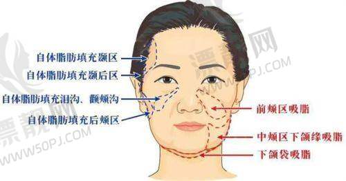 个体差异对成效显现的影响
