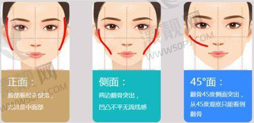 硅胶弹力线面部提升能改善法令纹且成效持久吗?