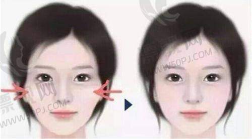 进口与否对价格的影响