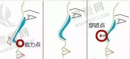 重要提醒