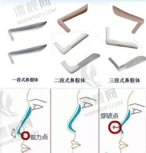 医院服务体验