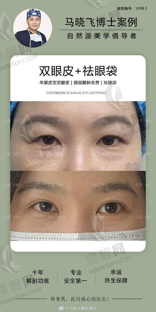 写给寻求改变的你：
