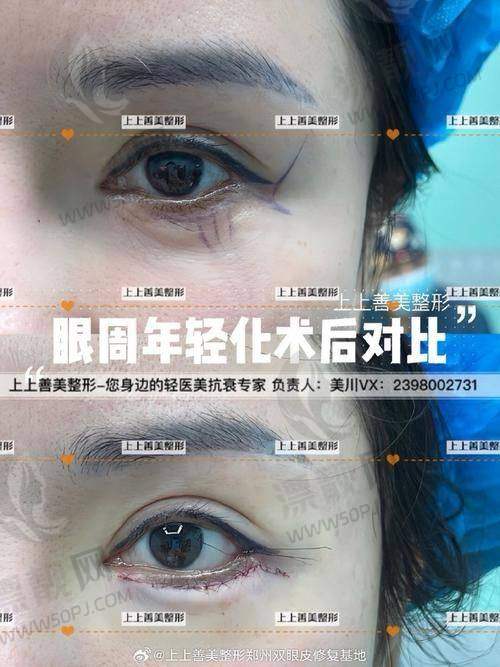 三家医院同台竞技，哪家适合你？