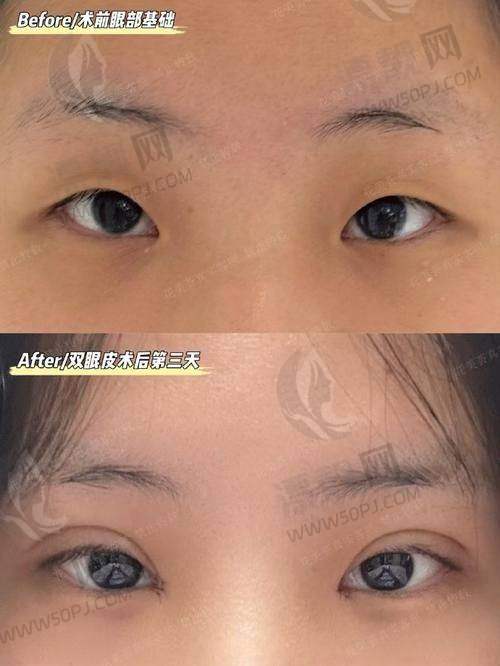 容貌经济如此火热，一定要选对了再动刀