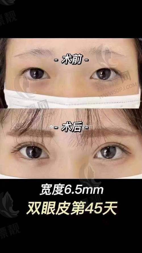 修复能力值得信赖？看这些“翻盘”实例就知道了