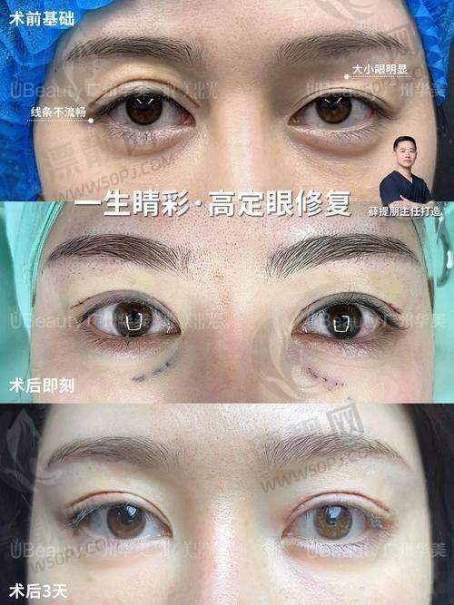 写在这里，不如写进你美丽的双眼