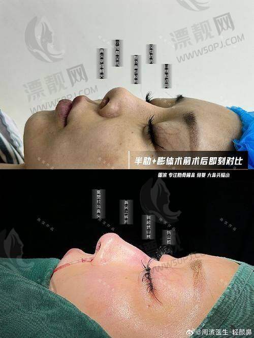 医生技术硬，临床经验三十载，说话有分量！