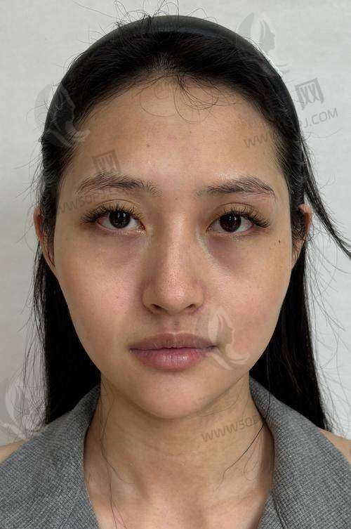 小Tips：为什么选择正规医院而非美容院？
