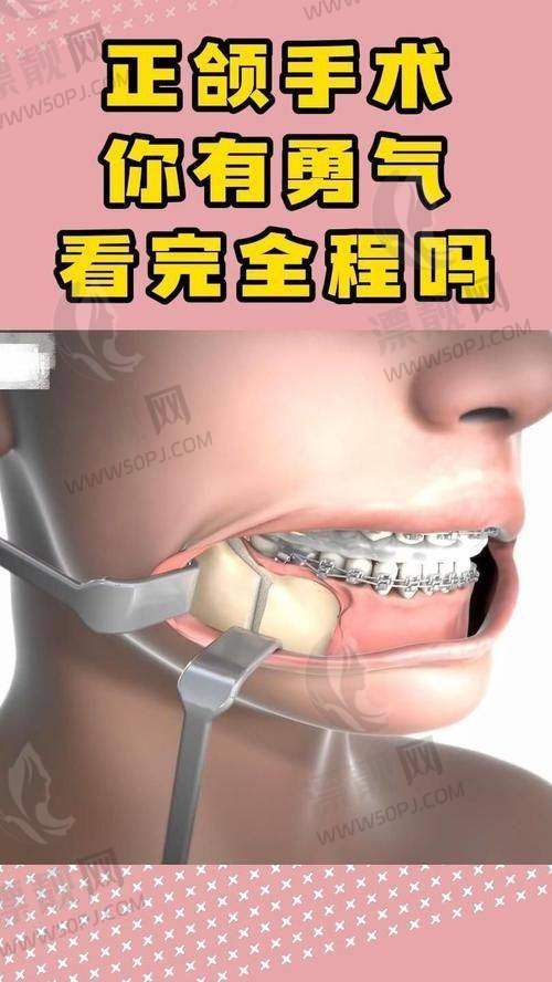 认领上海正颌手术医院排名，排名靠前的都是有实力的机构 附医院地址