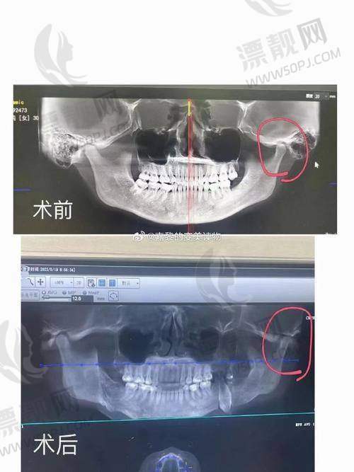 如何认领你的正颌之选？