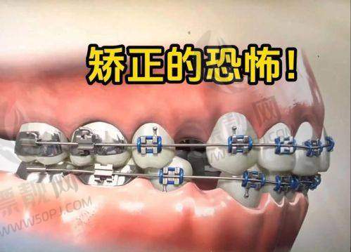 乌鲁木齐美奥口腔是坑人的吗？正规牙科当然不坑人而且看牙价格亲民呢