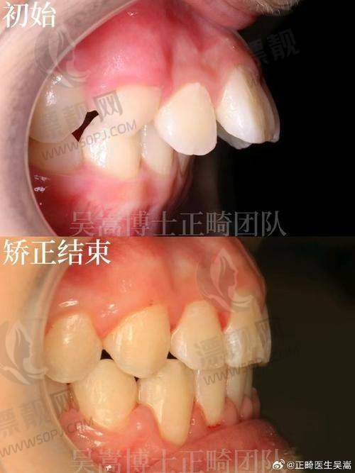 8. 福州四季齿科（主打舒适化看牙）